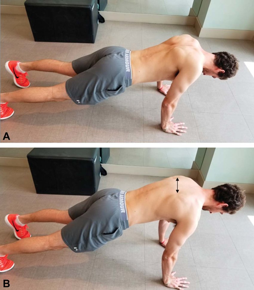 A-Start-of-push-up-plus-client-positioned-in-push-up-position-cue-to-retract-scapula.png