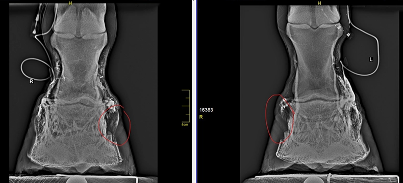 Venogram_Vergleichsbild.webp