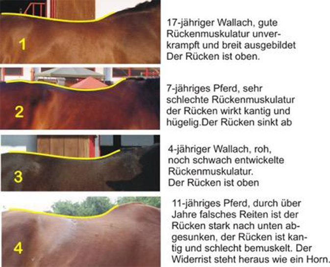 rueckenprobleme-vermeiden-teil-1-rueckenprobleme-und-kissing-spines (3).jpg