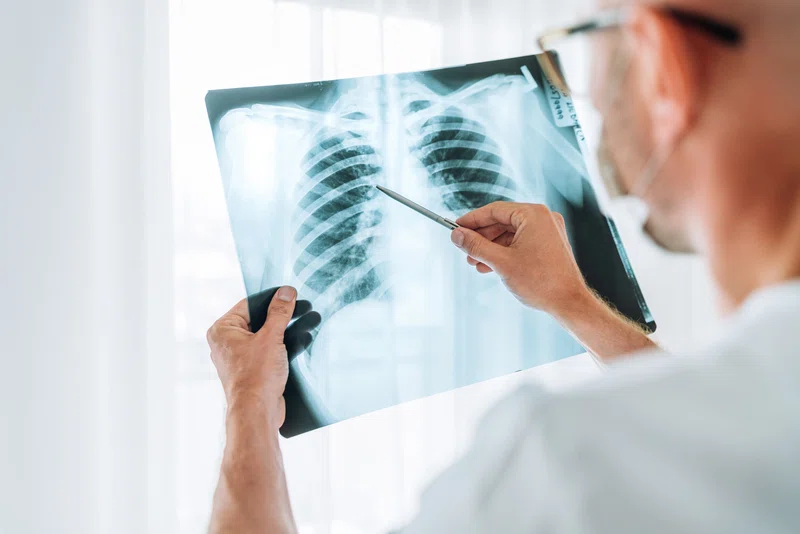 Doctor examining chest x-ray
