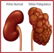 Enfermedad poliquística renal en gatos