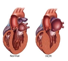 Cardiomiopatía hipertrófica felina