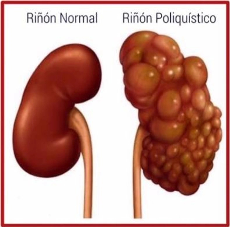 Enfermedad poliquística renal en gatos