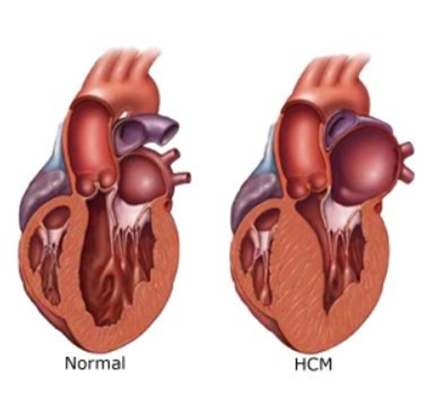 Cardiomiopatía hipertrófica felina